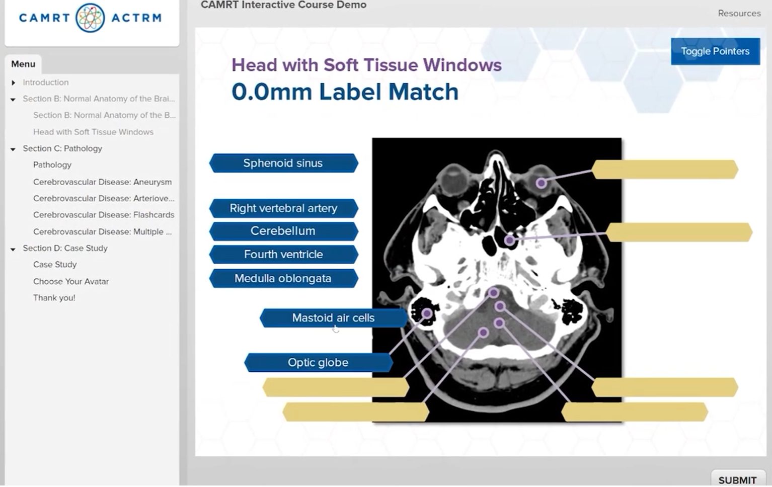 Drag-and-drop activity matching anatomy labels to points on a CT image